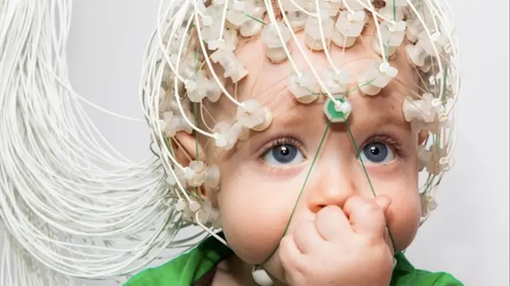 Figure 3: EEG was used to see the prevalence of fetal memories.