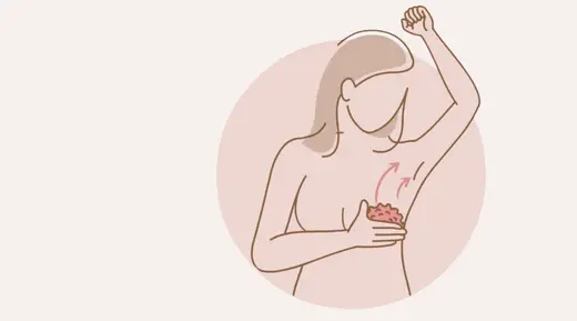 Drainage lymphatique manuel pour femme atteinte du cancer du sein