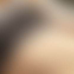 Unlocking Gut Health: How Traditional Chinese Medicine and Acupuncture Enhance Immunity