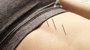 How does acupuncture work?