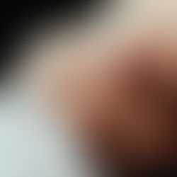 Understanding Connections Between Physical and Emotional Brain Centers: Its Impact on Your Life and How Acupuncture & PsychoKinesiology Can Help