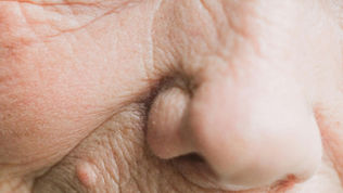 Signs of Yin Deficiency in Traditional Chinese Medicine and How to Restore Balance