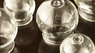 Cupping for the winter aches and pains!!!