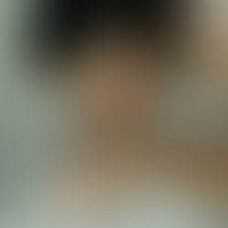 The Impact of Mouthwash Use on Diabetes