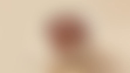Chocolate Addiction and Homeopathy