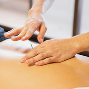 The Healing Power of Acupuncture for Common Ailments