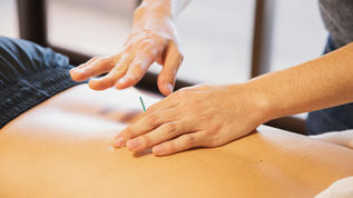 The Healing Power of Acupuncture for Common Ailments