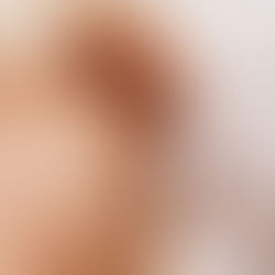 Acupuncture near me?