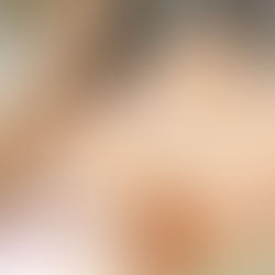 The Hidden Dangers of Weight Loss Drugs: Blood Deficiency and Pain