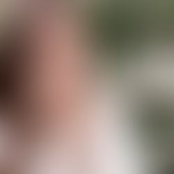 Peut-on guérir ses allergies par la naturopathie ? Approche globale