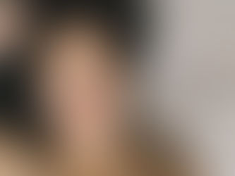 |03.07.2024| I was born with bad skin