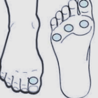 Diabetic feet assessment_edited_edited.png