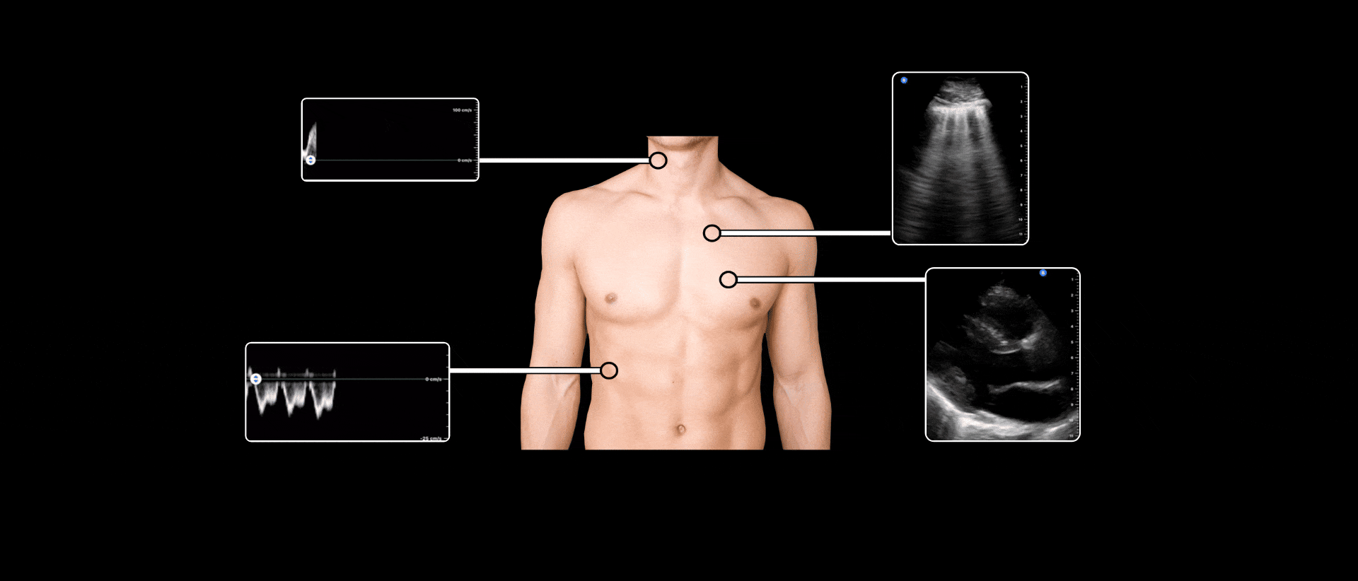 Point of care ultrasound POCUS Homepage.gif