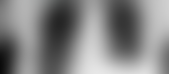 Diagnosing Pneumonia: the ultrasound is mightier than the x-ray