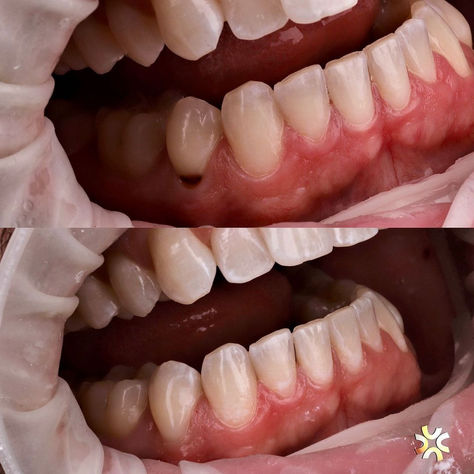 Da série... Um sorriso muda tudo!