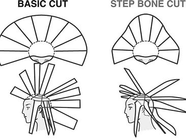 stepbonecut