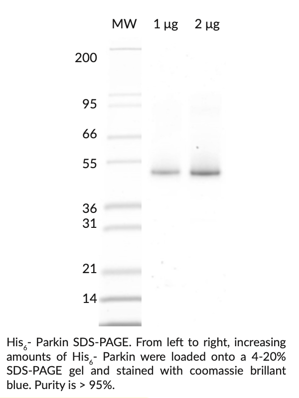 Parkin (Park2)