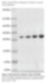 K29 Tetra Ubiquitin