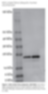 K63 Tetra-Ubiquitin