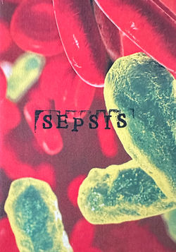 Sepsis
