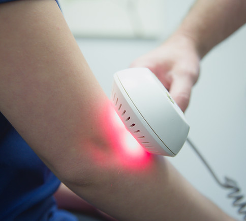 Laser Treatment