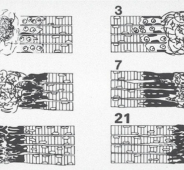 10.1177_0363546505274714-fig2.jpg