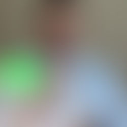 dr. Andrei comenta de uma paciente que superou a artrite e a fibromialgia tomando metotrexato e secuquinumabe