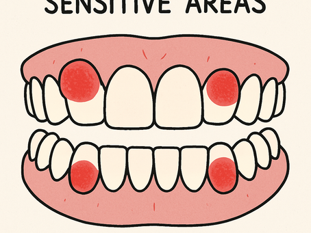 Illustration of teeth highlighting sensitive areas