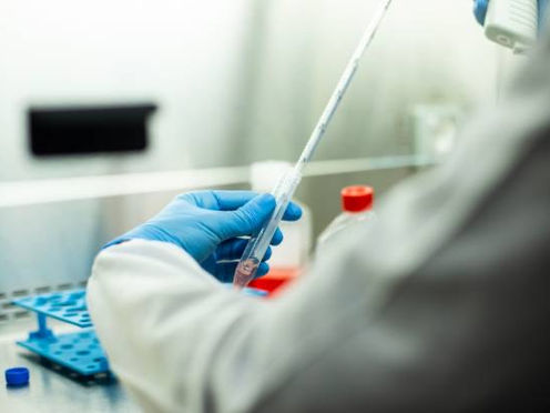 Ofrece IMSS Hidalgo pruebas rápidas de hepatitis C gratis