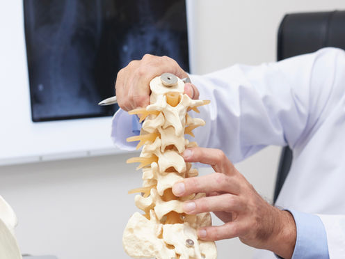 Promueve IMSS Hidalgo hábitos saludables para prevenir la osteoporosis