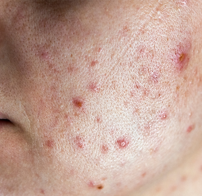 Beige Simple Minimalist Armpit Waxing Your Story (Instagram Post)(13).png