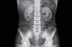 Abdomen X-ray Scan