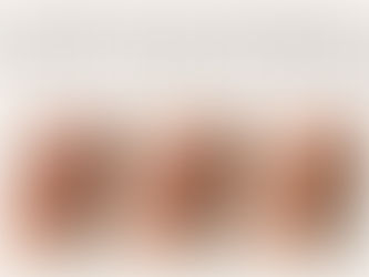 What is normal after laser tattoo removal?