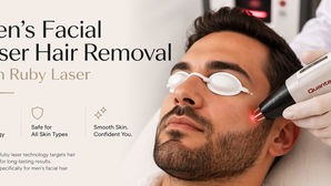 Men’s Facial Laser Hair Removal | Ruby laser Technology