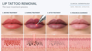 Lip PMU removal How Laser Removes Permanent 