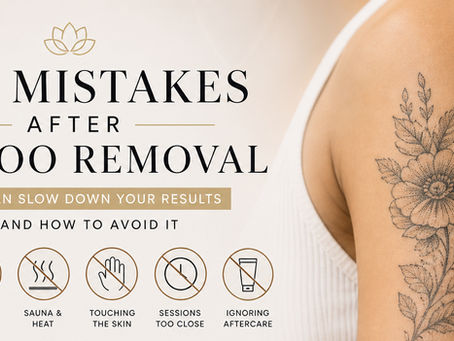 Top Mistakes After Tattoo Removal