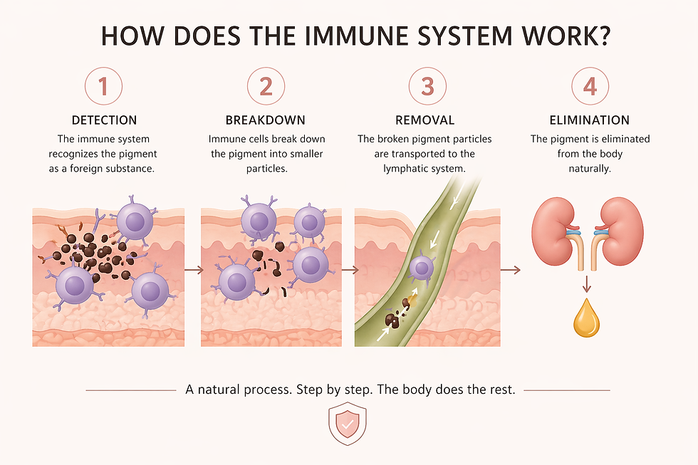 After fragmentation, the body’s immune system gradually removes the pigment, leading to progressive fading.