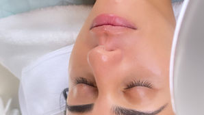 Healthy skin after deep cleaning facial