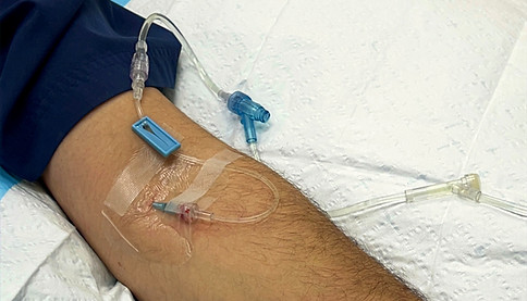 blood draw