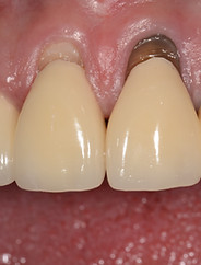 Case3_Baseline