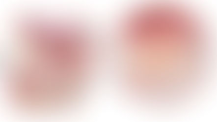 Unravel the complexities of prostate cancer management