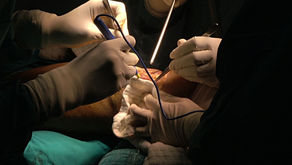 Predictors of Receiving a Prosthesis for Adults With Above-Knee Amputations 