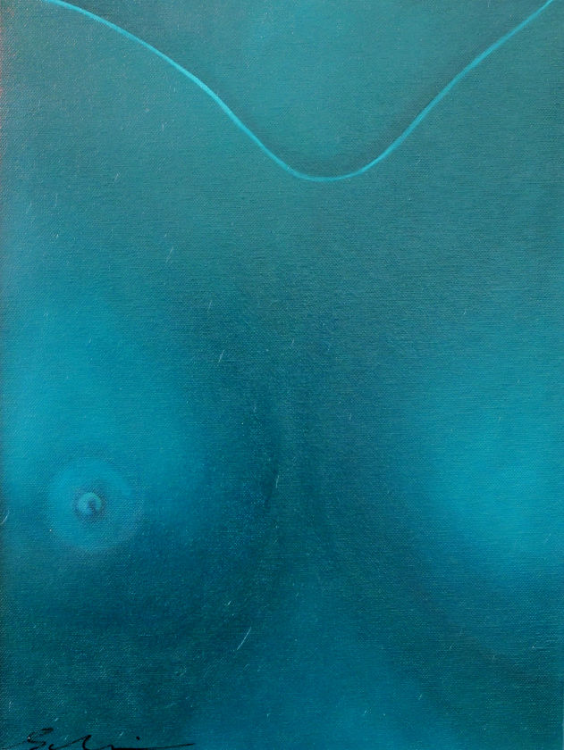341