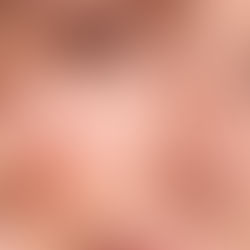 A person applies sunscreen to their cheek, showing smooth skin and a subtle smile, in a close-up shot.