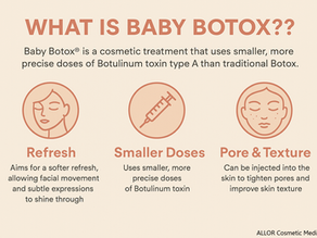 Infographic titled "What is Baby Botox?" explains benefits: Refresh, Smaller Doses, Pore & Texture. Simple icons and text on beige background.