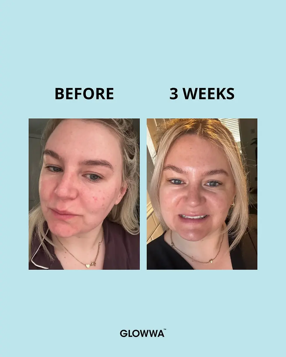 Thumbnail: GLOWWA Collagen Creamer - 15 DAY SUPPLY