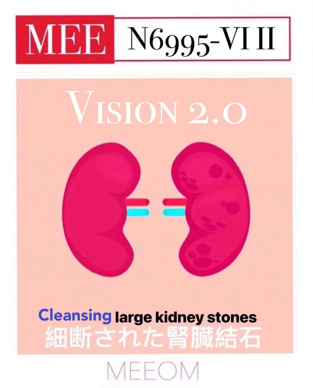 MEE N6995 VI II, V2.0, innovative treatment of kidney stones 腎臓結石の治癒を成功させる革新的なメカ