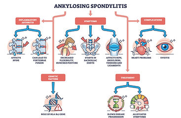 Beyond the Joints: Extra-articular Manifestations AS is more than just a spinal condition. It can affect other organs and systems, leading to: •	Inflammatory bowel disease – occurs in up to 50% of individuals with AS •	Acute anterior uveitis (eye inflammation) – seen in 25–35% of cases •	Psoriasis – affects about 10% of patients •	Cardiovascular disease – linked to systemic inflammation •	Pulmonary complications – reduced chest expansion can lead to a restrictive breathing pattern