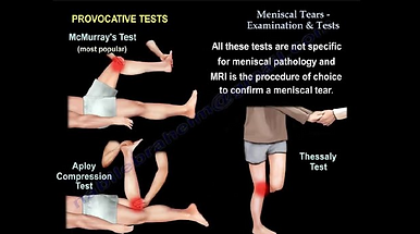 Provocation tests for the knee