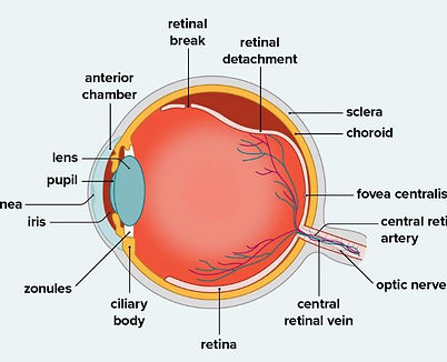 distacco retina.JPG